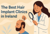 The Best Hair Implant Clinics in Ireland bikrisohoj